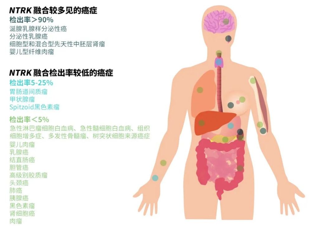 《闪耀全球的首个“不限癌种”抗癌药，终于登陆中国！“有效率75%、能治17种癌症”，拉罗替尼为何能交出这张史无前例的“成绩单”》